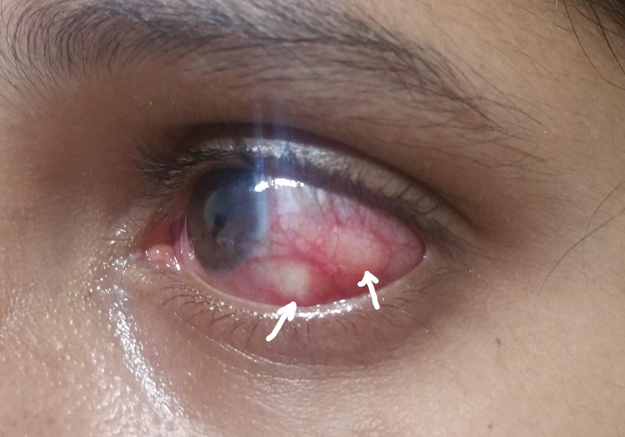 Ocular-Imaging