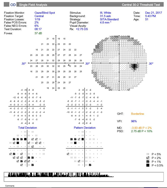 Visual Fields