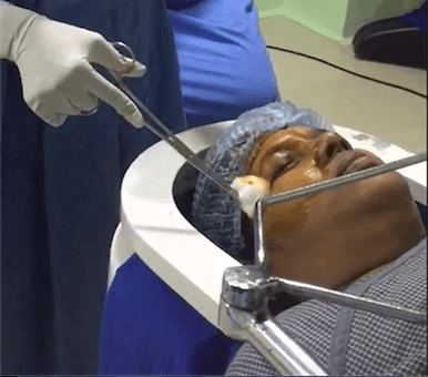 Guide to Intravitreal Injections: Indications, Do's, Don'ts, & Myths