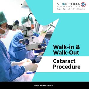 cornea, retina, cataract