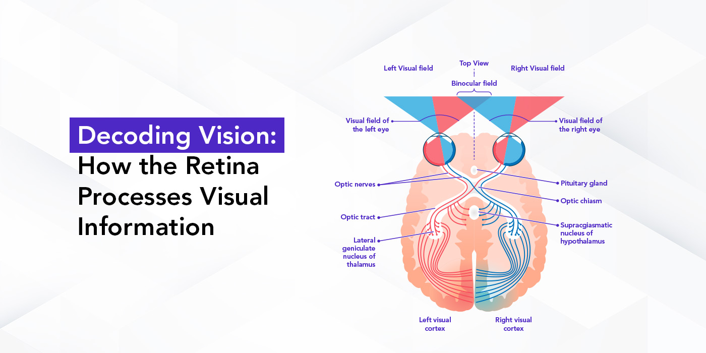 Neoretina Blog | Cataract Surgery, Post-Operative Care | Neoretina