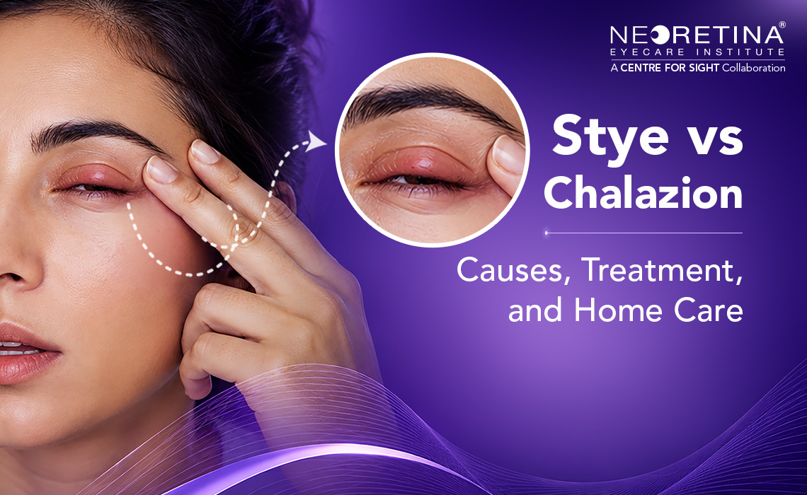 Stye in Eye