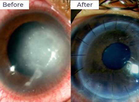 Neoretina Case Studies