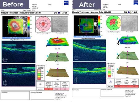 Neoretina Case Studies